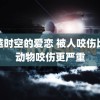 跨越时空的爱恋 被人咬伤比被动物咬伤更严重